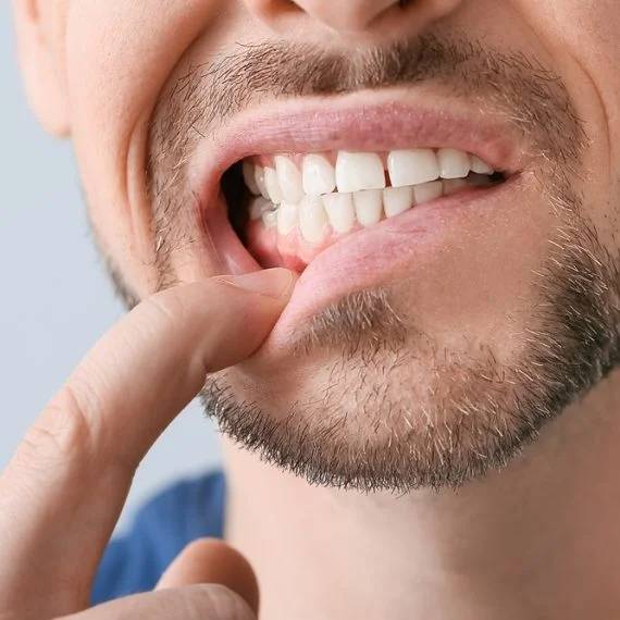 early gum disease signs