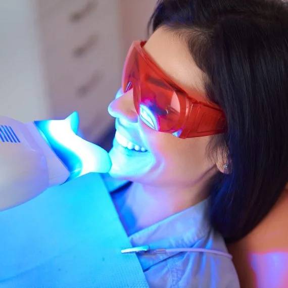 teeth whitening in Toronto