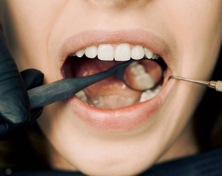 modern dentures in Toronto