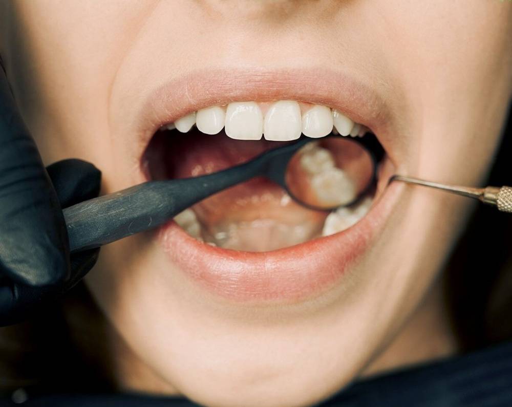 modern dentures in Toronto